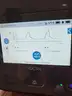 VOCSN Ventilator Pro