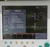 Datex-Ohmeda S/5 Avance Anesthesia Machine