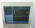 Ultrasim UST 100 Ultrasound System ID:4139