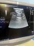 GE Healthcare Logic 9 Ultrasound (AS50)
