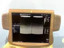 GE Healthcare Logic 9 Ultrasound (AS50)