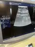 GE Healthcare Logic 9 Ultrasound (AS50)