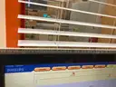 Philips 3D-RA X-ray machine (C-arm), Patient Table, Controls, Acist Contrast Delivery System