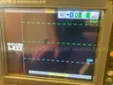 Physio Control LIFEPAK 15 Defibrillator