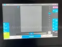SonoSite X-Porte Ultrasound Machine
