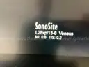 SonoSite X-Porte Ultrasound Machine