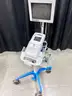 Lot of Ultrasound Equipment (408-42)