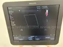 Philips ClearVue 650 Ultrasound System