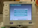 Terumo BCT Spectra Optia Apheresis System